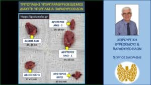 Χειρουργικό παρασκεύασμα