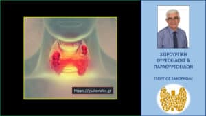 Θυλακιώδες νεόπλασμα θυρεοειδούς απροσδιόριστης βιολογικής συμπεριφοράς (FT-UBB, follicular tumor or uncertain biological behavior) – ποιος ο ρόλος της θεραπείας με ραδιενεργό ιώδιο?