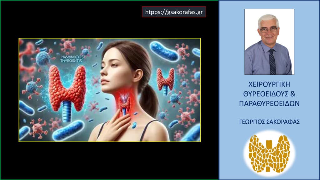 Home Θυρεοειδίτιδα Hashimoto – γιατί είναι τόσο συχνή?
