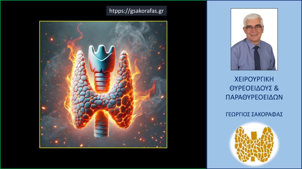 Home Θυρεοειδίτιδα Hashimoto – αποτελέσματα της χειρουργικής επέμβασης σε μία «δύσκολη» υπο-ομάδα ασθενών