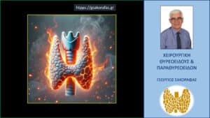 Θυρεοειδίτιδα Hashimoto – αποτελέσματα της χειρουργικής επέμβασης σε μία «δύσκολη» υπο-ομάδα ασθενών