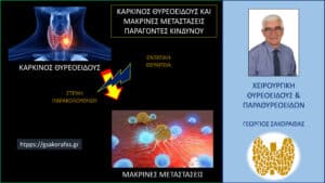 Καρκίνος θυρεοειδούς και μακρινές μεταστάσεις – παράγοντες κινδύνου
