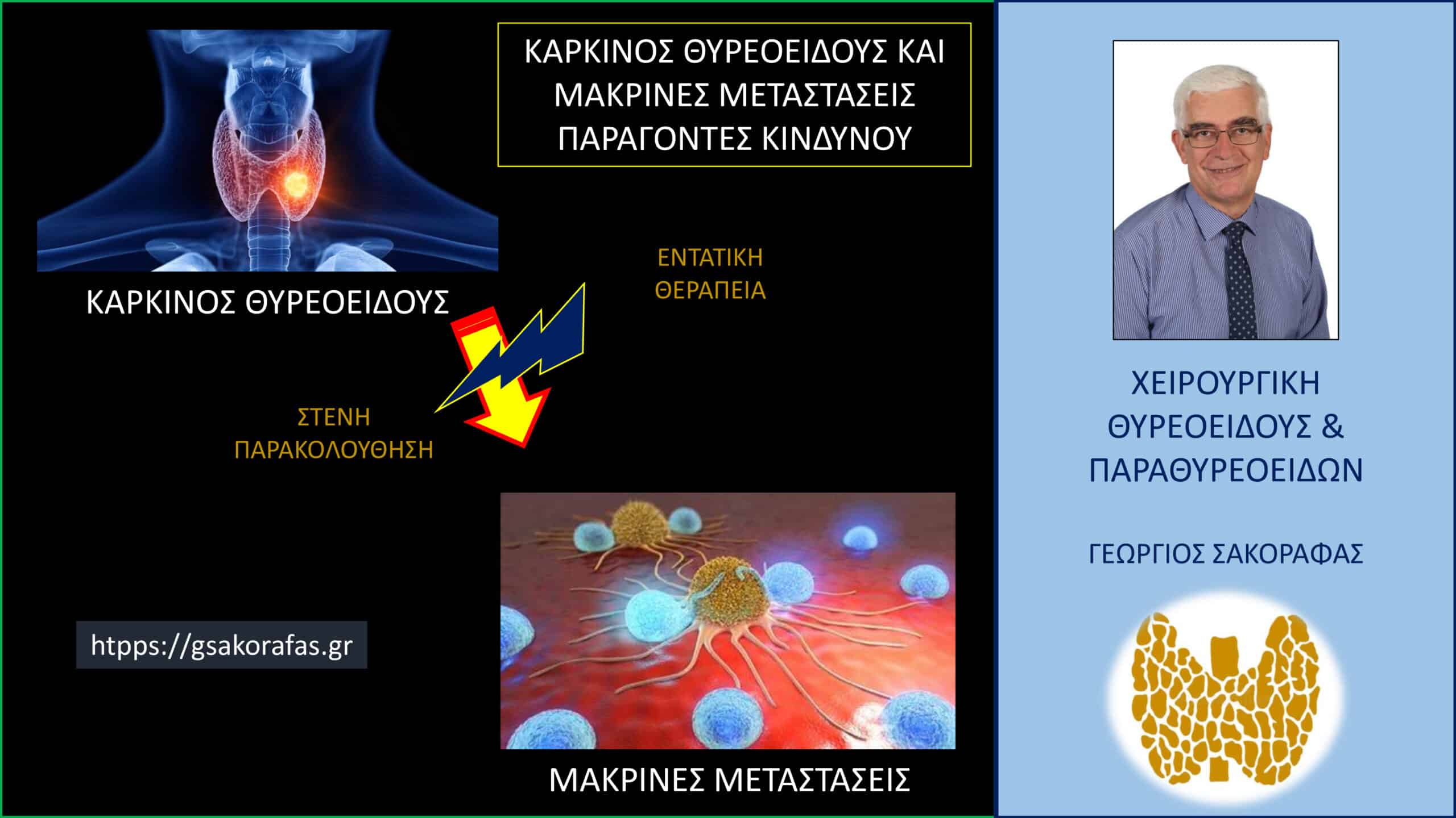 Καρκίνος θυρεοειδούς και μακρινές μεταστάσεις – παράγοντες κινδύνου