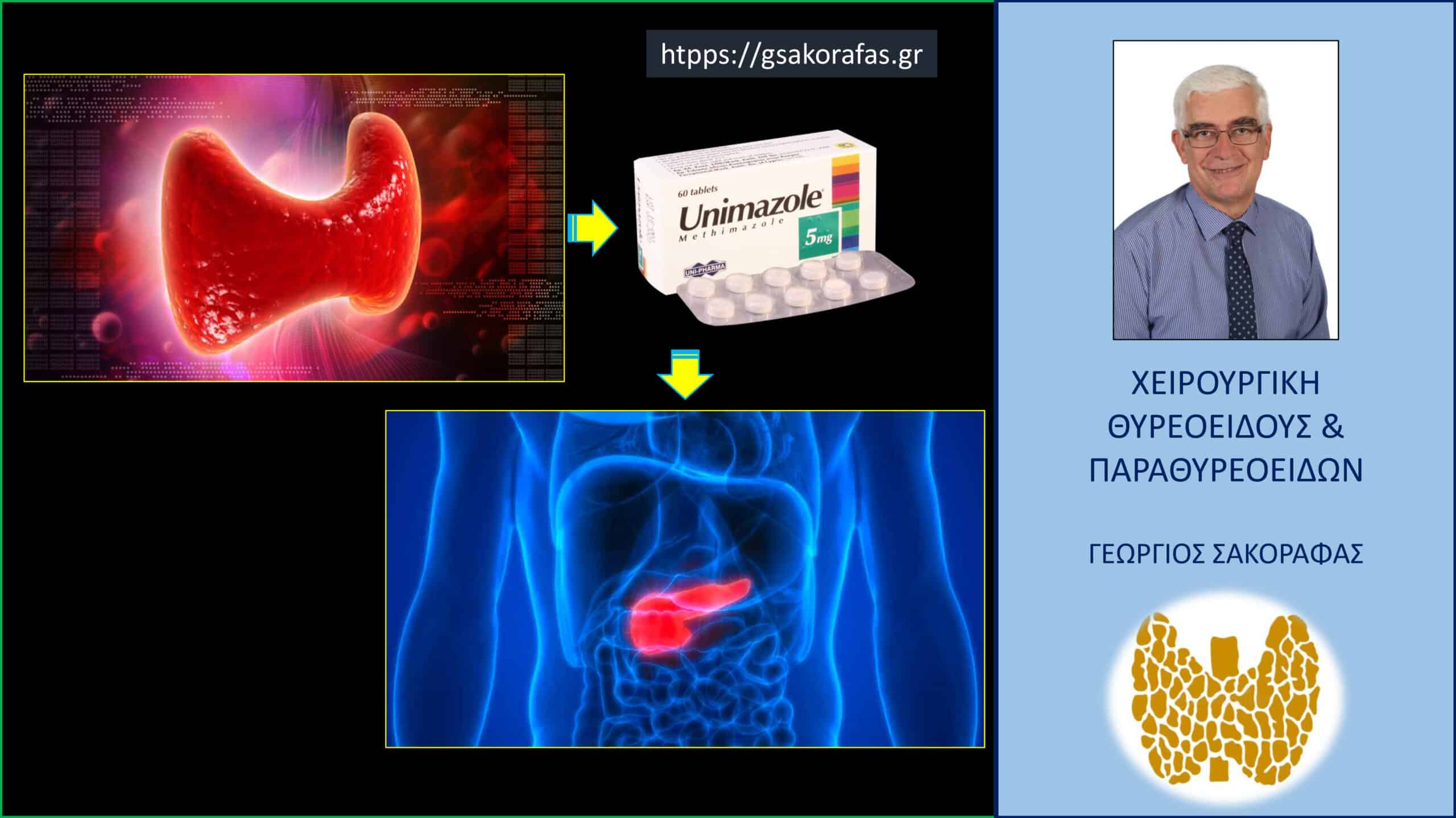 Νόσος Graves και unimazole – παγκρεατίτιδα σε ασθενή μας