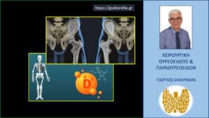 Παραθορμόνη και οστεοπόρωση
