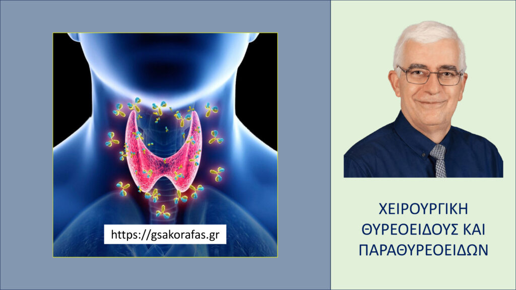 Home Θυρεοειδίτιδα Hashimoto και υπερθυρεοειδισμός – μπορεί να συνυπάρχουν?