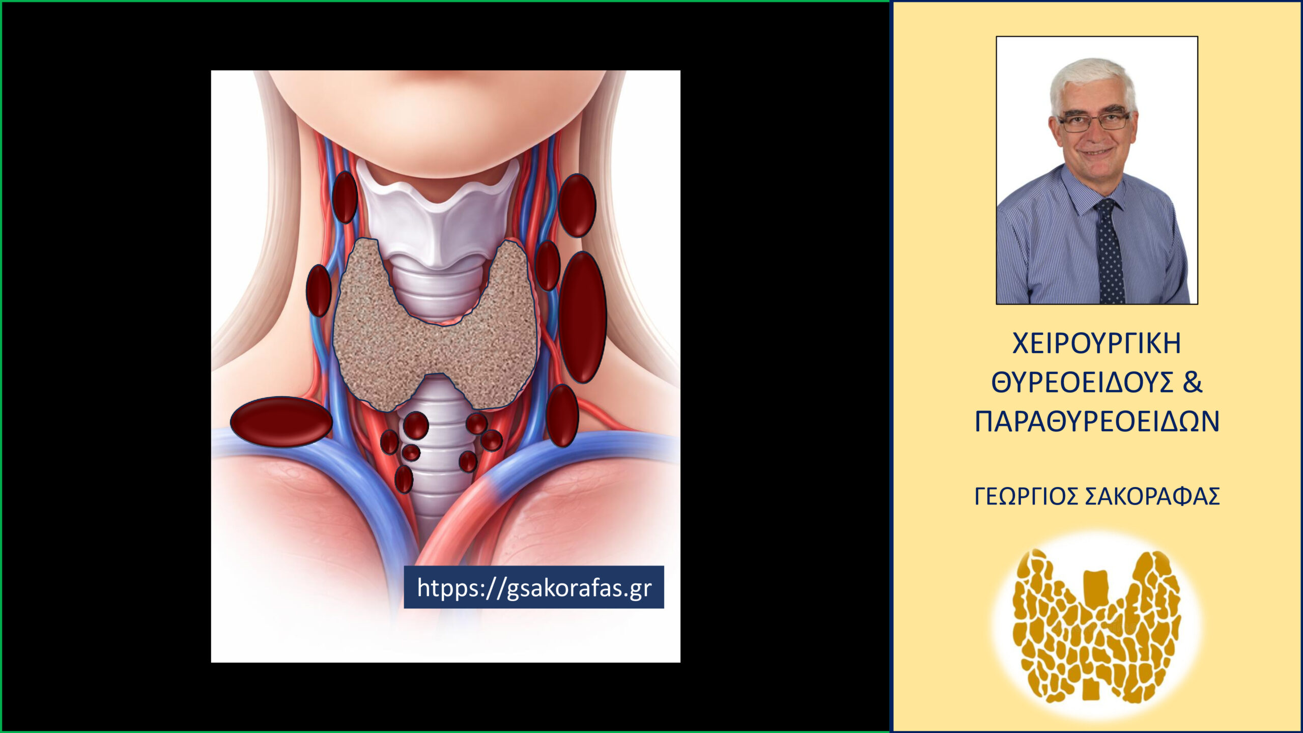 Επιθετικός καρκίνος θυρεοειδούς σε νεαρό ασθενή μας με προεγχειρητική διάγνωση παραπομπής «βρογχοκήλη»