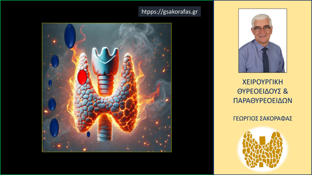 Home Καρκίνος θυρεοειδούς - σχηματική απεικόνιση των ευρημάτων στην χαρτογράφηση λεμφαδένων τραχήλου . Σημειώνεται η παρουσία πολλαπλών παθολογικών λεμφαδένων στα πλάγια ανατομικά διαμερίσματα του τραχήλου (κυρίως) (βλ. κείμενο)