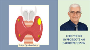 Υπερπαραθυρεοειδισμός  – χρειάζεται χορήγηση ασβεστίου μετά την επιτυχή αντιμετώπισή του?
