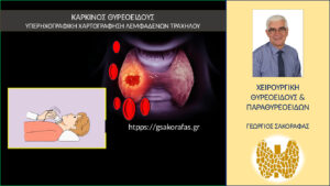 Χαρτογράφηση λεμφαδένων τραχήλου στον καρκίνο θυρεοειδούς – o ρόλος του ακτινολόγου και του χειρουργού Χαρτογράφηση λεμφαδένων τραχήλου στον καρκίνο θυρεοειδούς – o ρόλος του ακτινολόγου και του χειρουργού