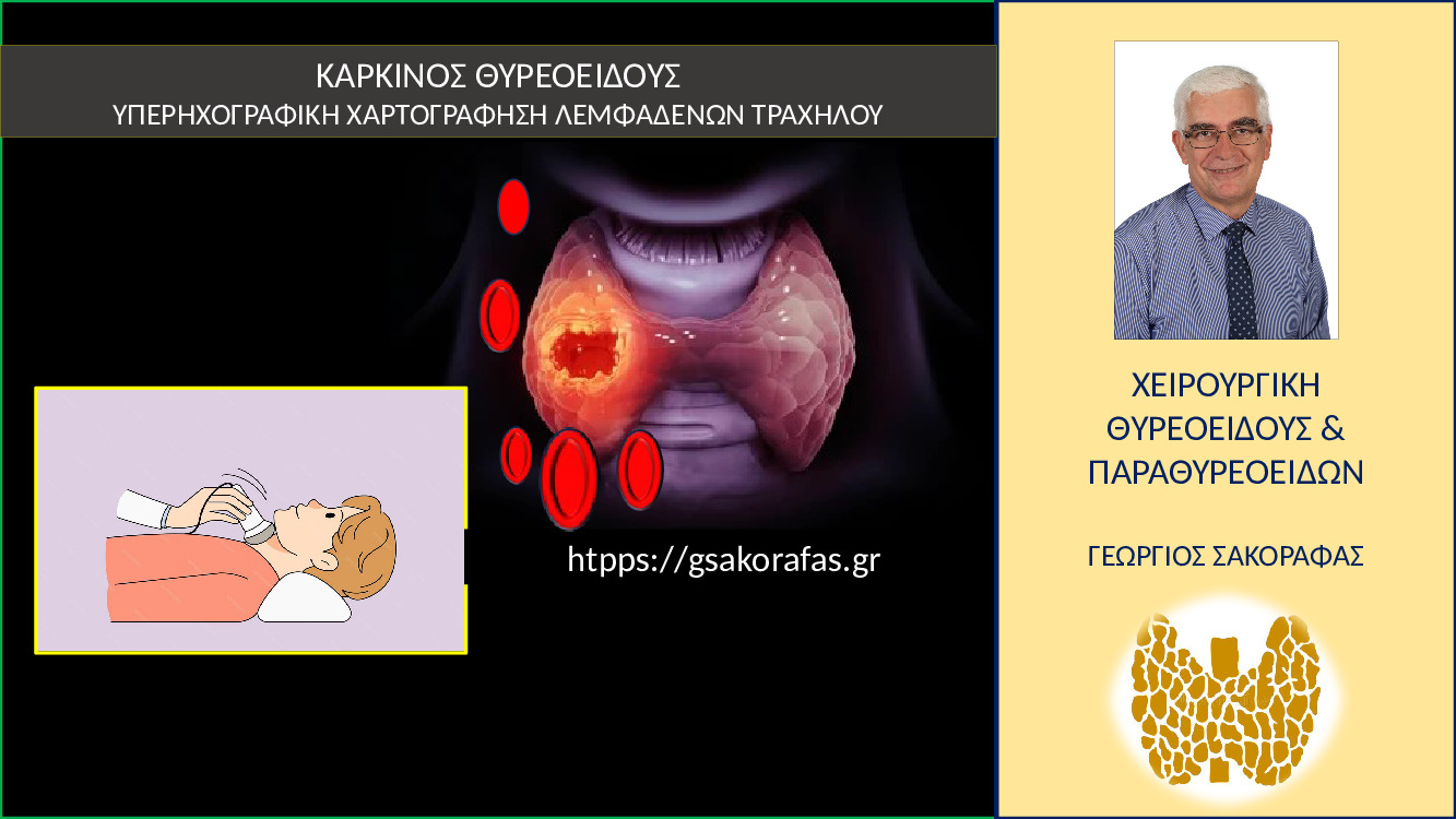 Χαρτογράφηση λεμφαδένων τραχήλου στον καρκίνο θυρεοειδούς – o ρόλος του ακτινολόγου και του χειρουργού