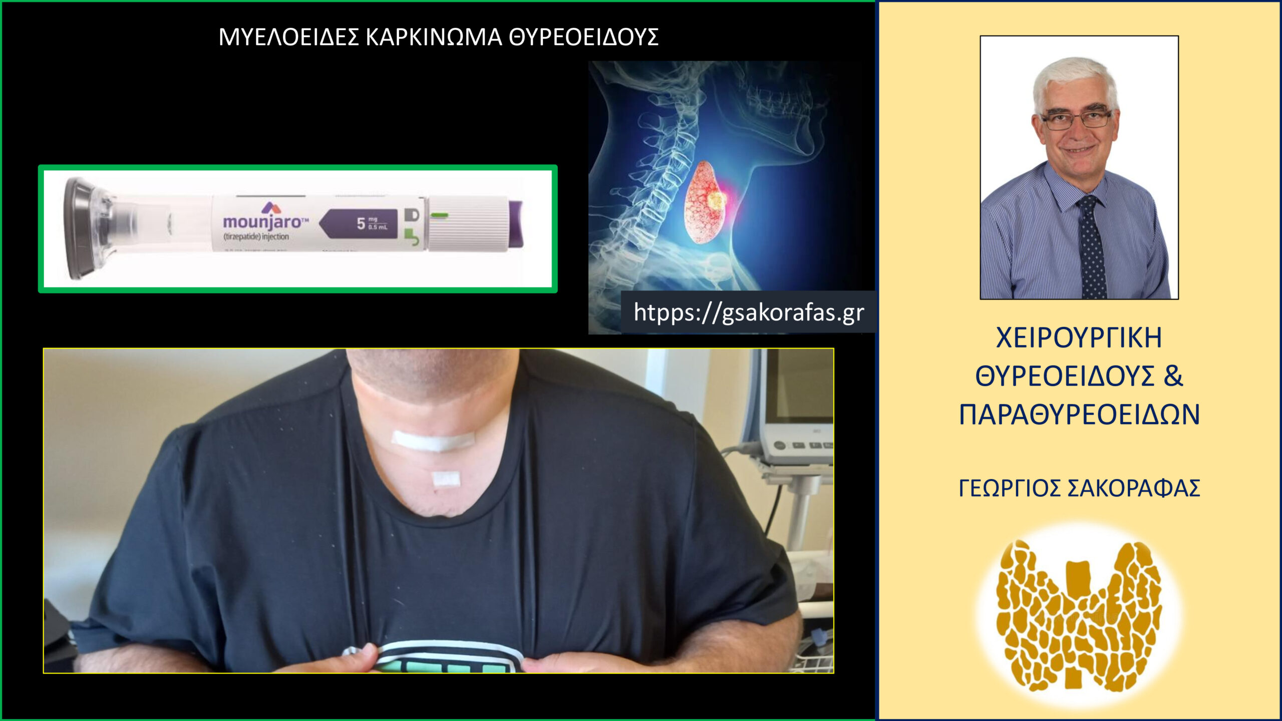 Μυελοειδής καρκίνος θυρεοειδούς – «έμμεση» διάγνωση στα πλαίσια του προληπτικού ελέγχου πριν την χορήγηση φαρμάκου για την παχυσαρκία σε ασθενή μας με νοσογόνο παχυσαρκία