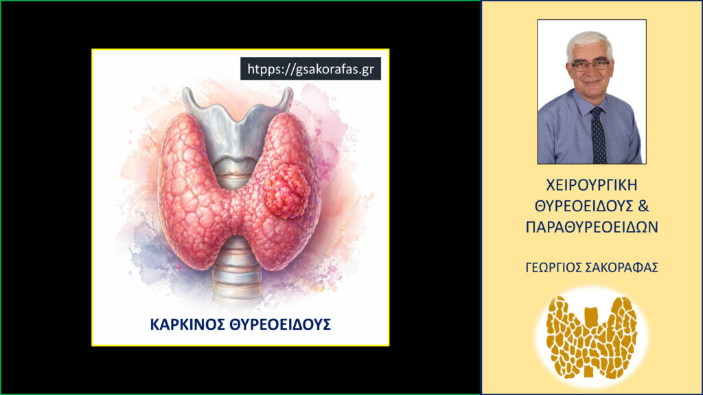 Home Καρκίνος θυρεοειδούς -όταν η σύγχρονη αντιμετώπισή του κάνει την ελπίδα πραγματικότητα