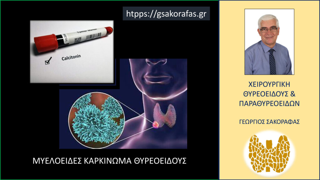 Home Καλσιτονίνη και μυελοειδές καρκίνωμα θυρεοειδούς – πώς εξελίσσονται τα επίπεδα της καλσιτονίνης μετά από επιτυχή και ριζική χειρουργική αντιμετώπιση της νόσου και τι σημασία έχει η παρακολούθησή τους?