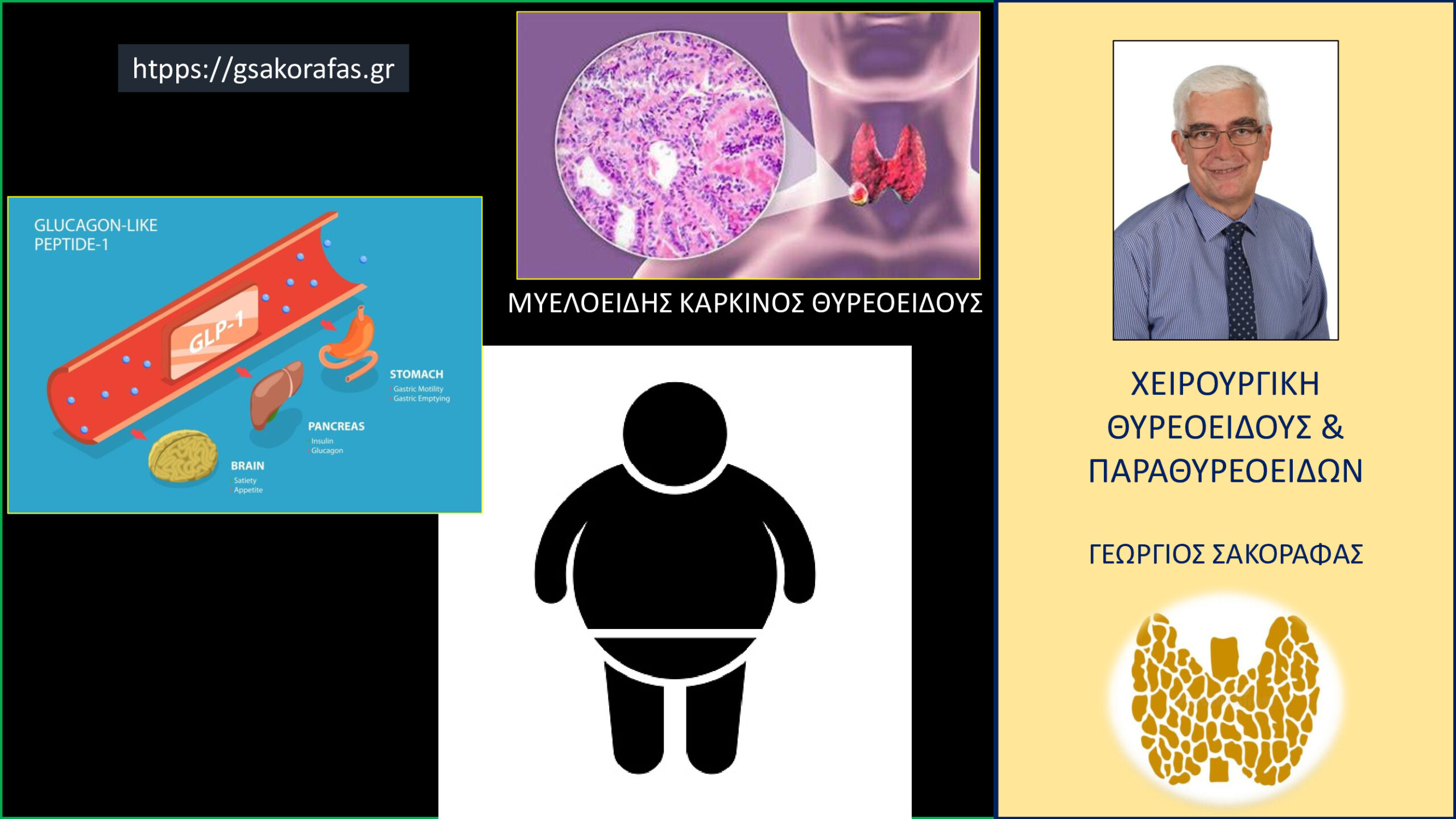 Μυελοειδής καρκίνος θυρεοειδούς και φάρμακα κατά της παχυσαρκίας