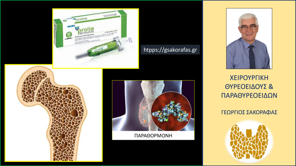 Home Παραθορμόνη και Prolia