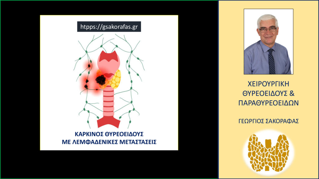 Home Λεμφαδένες λαιμού (τραχήλου) και οι παθήσεις του θυρεοειδούς