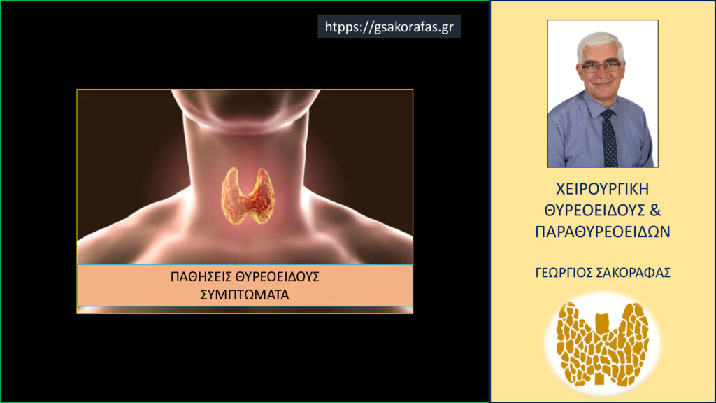 Home Θυρεοειδής συμπτώματα και θεραπεία