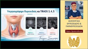 Tirads Στον Θυρεοειδή: Τι Σημαίνει Το Αποτέλεσμα Του Υπερηχογραφήματος; (3,4,5) Tirads 3, 4 Ή 5 Στον Θυρεοειδή: Τι Σημαίνει Το Αποτέλεσμα Του Υπερηχογραφήματος;