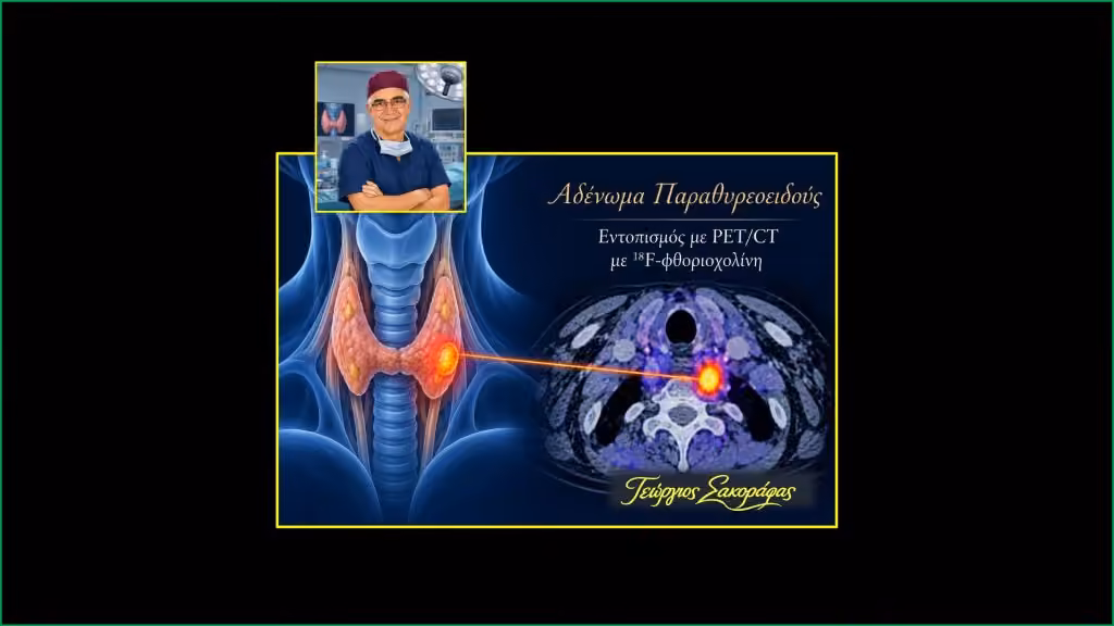 Home Αδένωμα Παραθυρεοειδούς Και Pet/Ct Με 18F-Φθοριοχολίνη